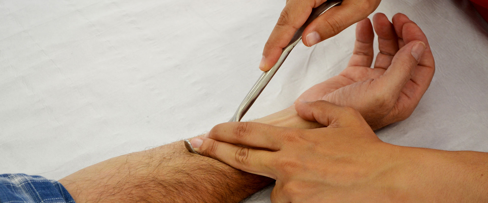 Fribrolisis con gancho