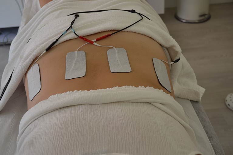 Electroestimulación