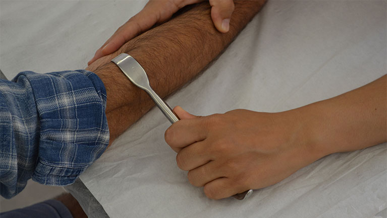 Fibrolisis con gancho